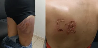 Mulher é resgatada de cárcere privado e tortura pelo marido em Cosmorama-SP