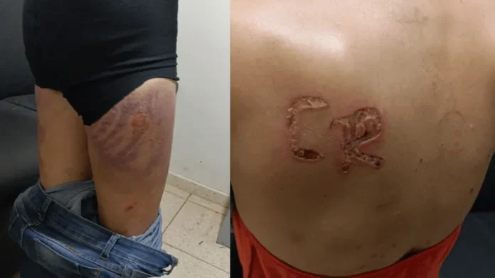 as-marcas-no-corpo-da-vitima-foram-feitas-com-ferro-quente-114420_800x450