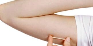 Planos de saúde passam a cobrir implante contraceptivo Implanon a partir de hoje