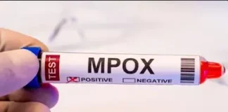 Brasil registra 88 casos de Mpox em 2026